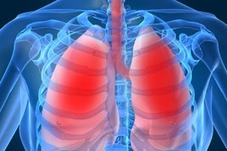 Évente több mint 30 ezren halnak meg rákban